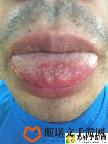 舌头进去吃小豆豆，网友直言：这究竟是怎样的一种体验？游戏玩法